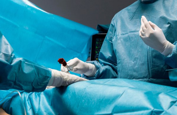 Cirugía de hernia inguinal y umbilical en CDMX y Naucalpan